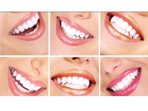 牙齿修复方法一：树脂修复